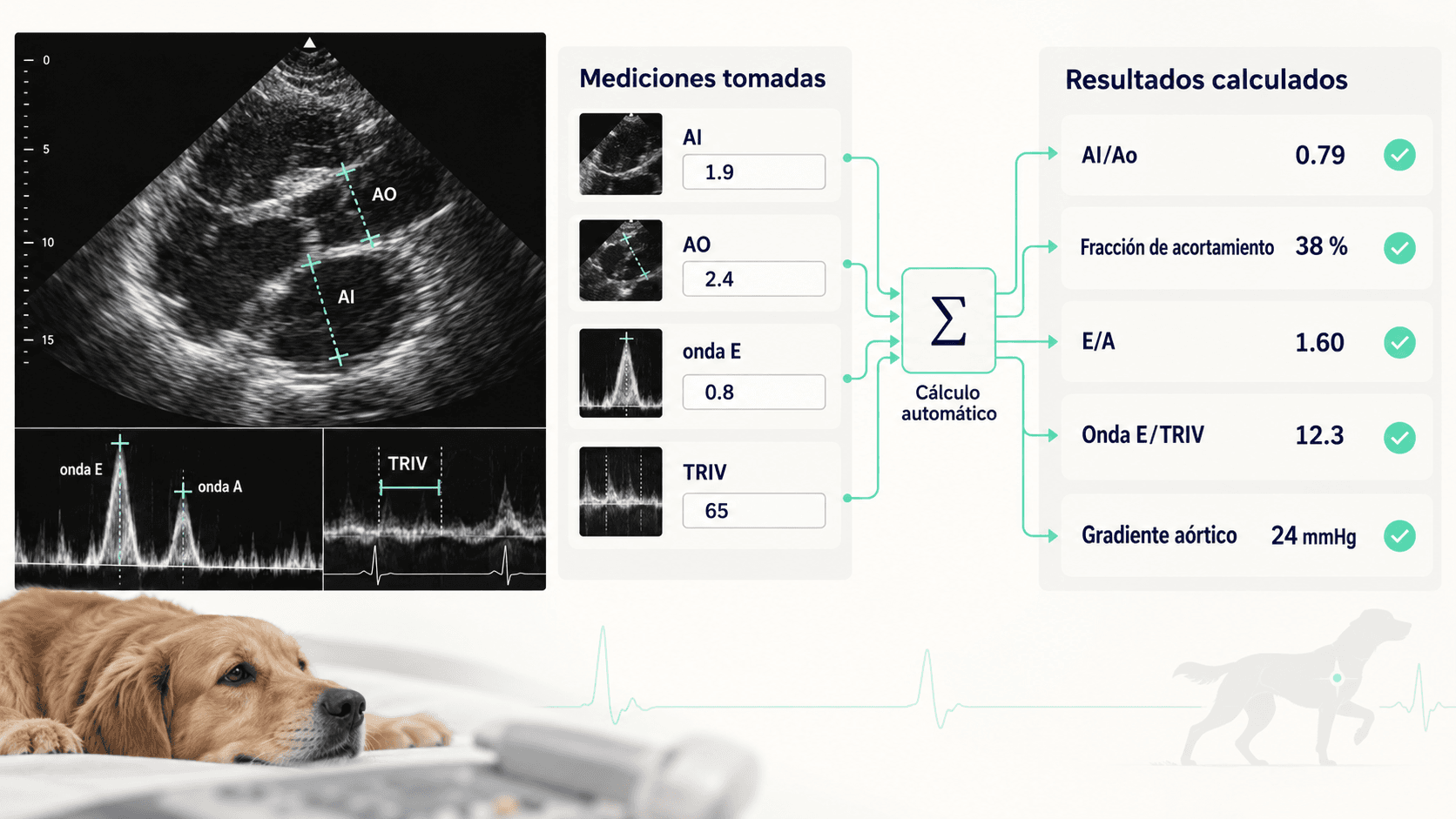 Visualización del cálculo automático de mediciones cardiológicas: AI, AO, onda E y TRIV se conectan con relaciones, índices y gradientes calculados